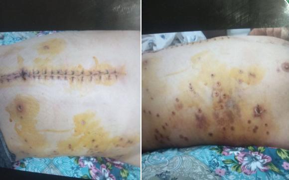 بدن او سند جنایتی است که نباید فراموش شود بدن این جوان، گواهی بر خشونت علیه معترضان